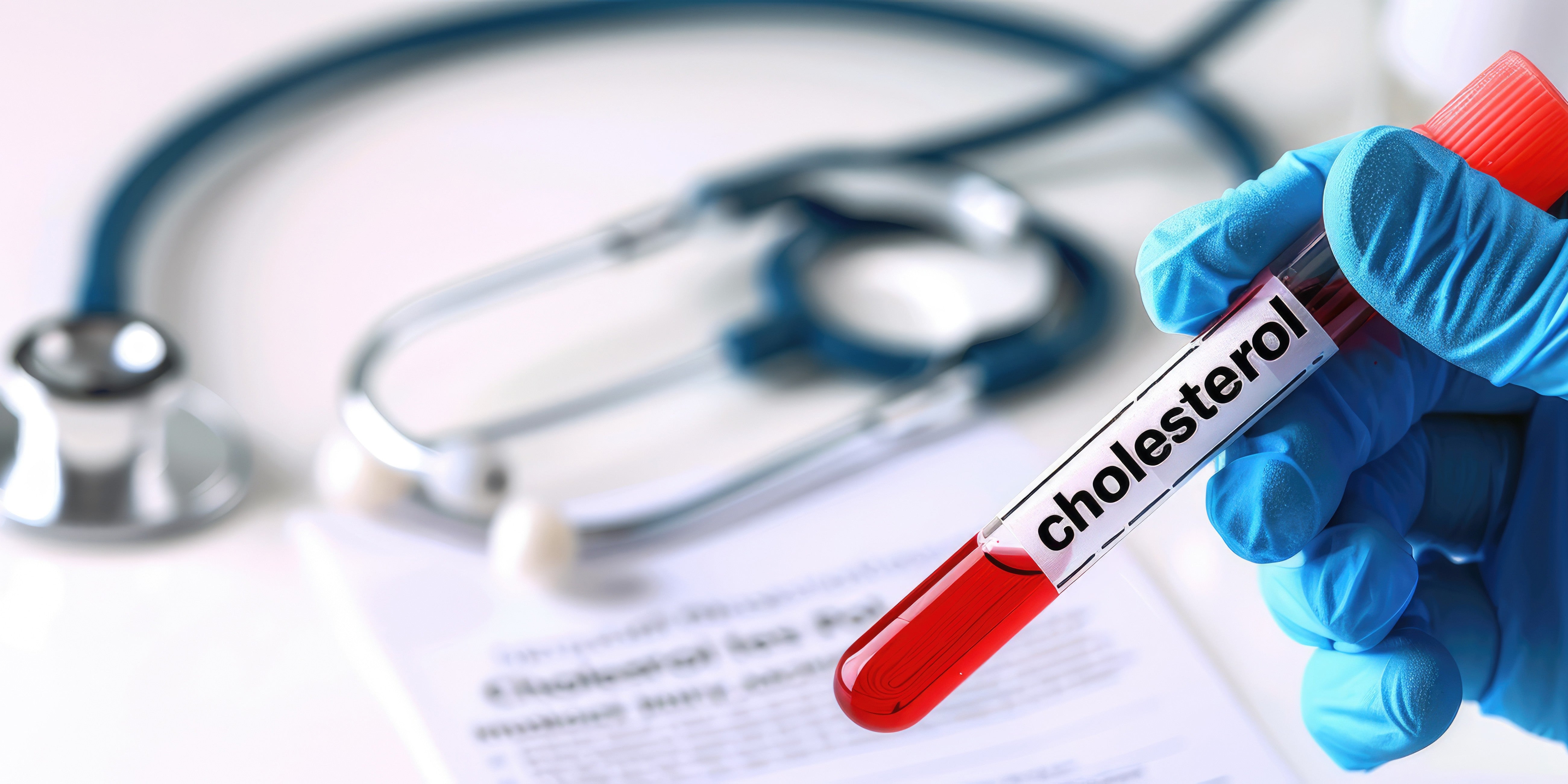 Cholesterol and the Carnivore Diet